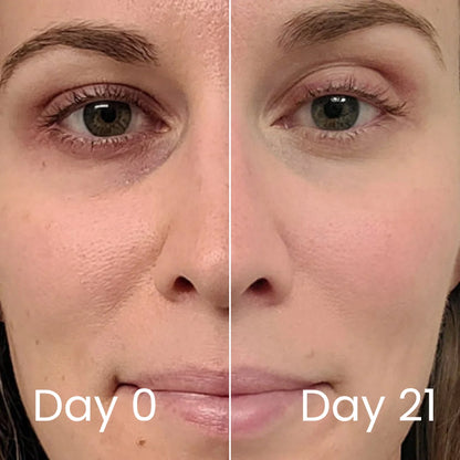 Genesis Vitality Wand