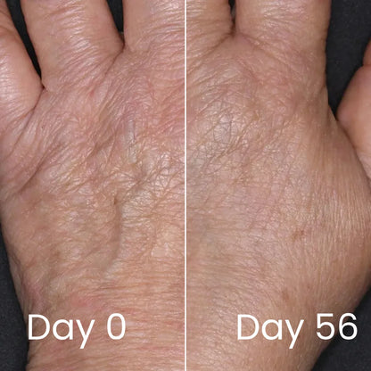 Genesis Vitality Wand