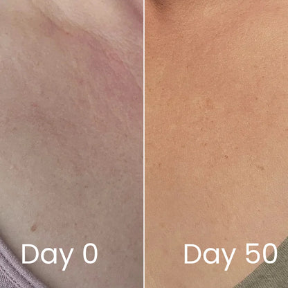 Genesis Vitality Wand