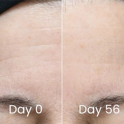 Genesis Vitality Wand